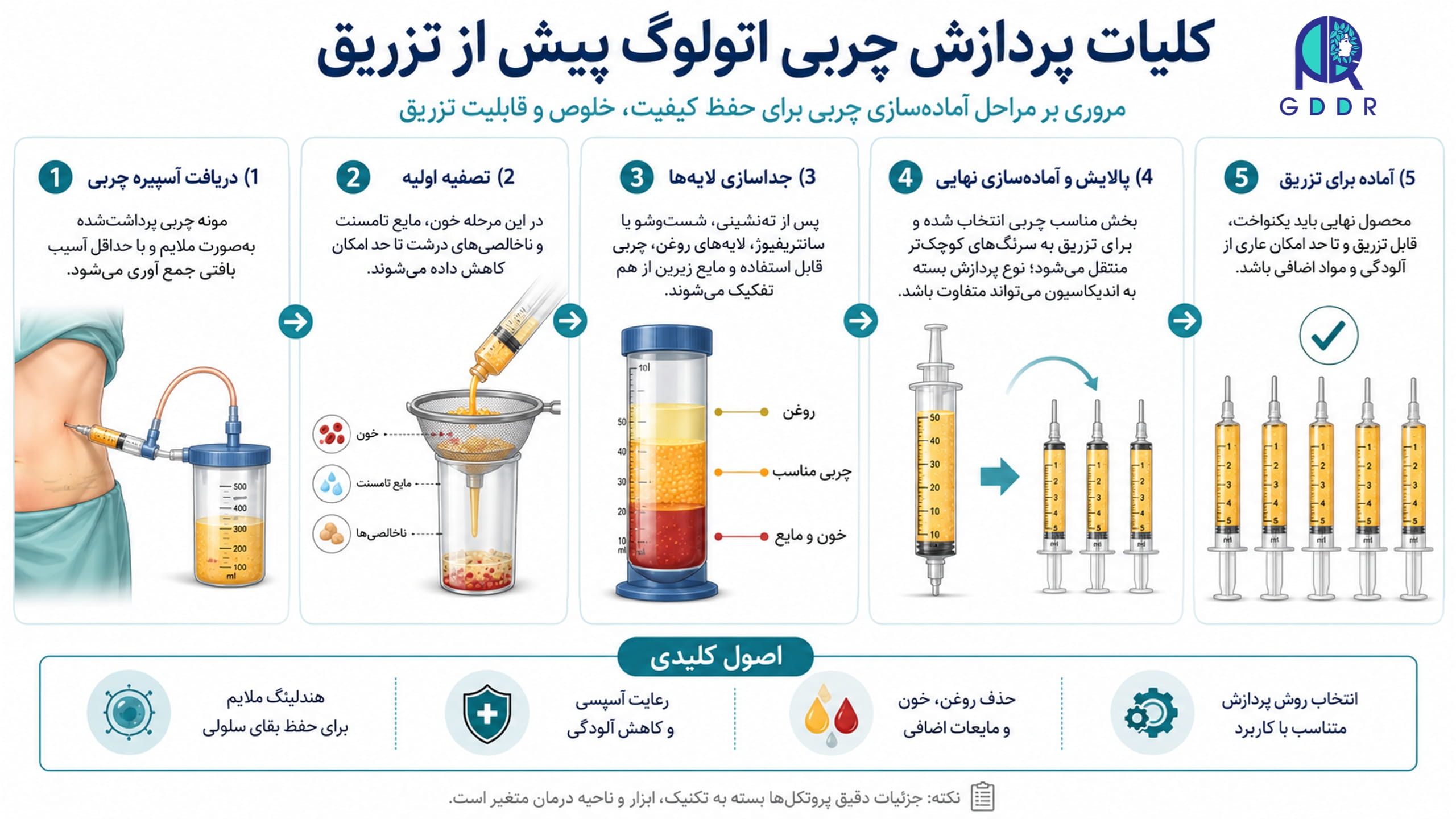 کلیات پردازش چربی برداشت شده (هاروست شده) برای آماده سازی جهت تزریق در محل گیرنده