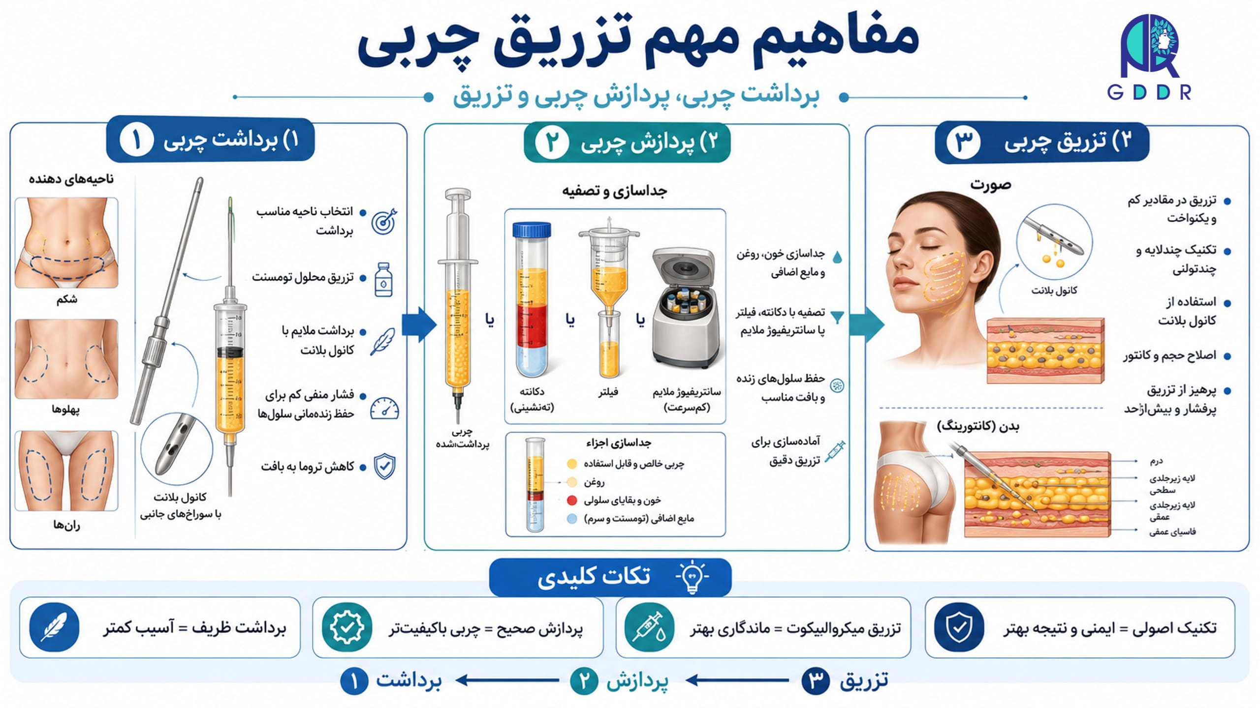 مفاهیم مهم و ارزشمند تزریق چربی اتولوگ در یک تصویر اینفوگرافیک