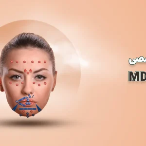 تزریق ژل با تکنیک md codes