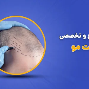 معرفی دوره آموزش کاشت مو