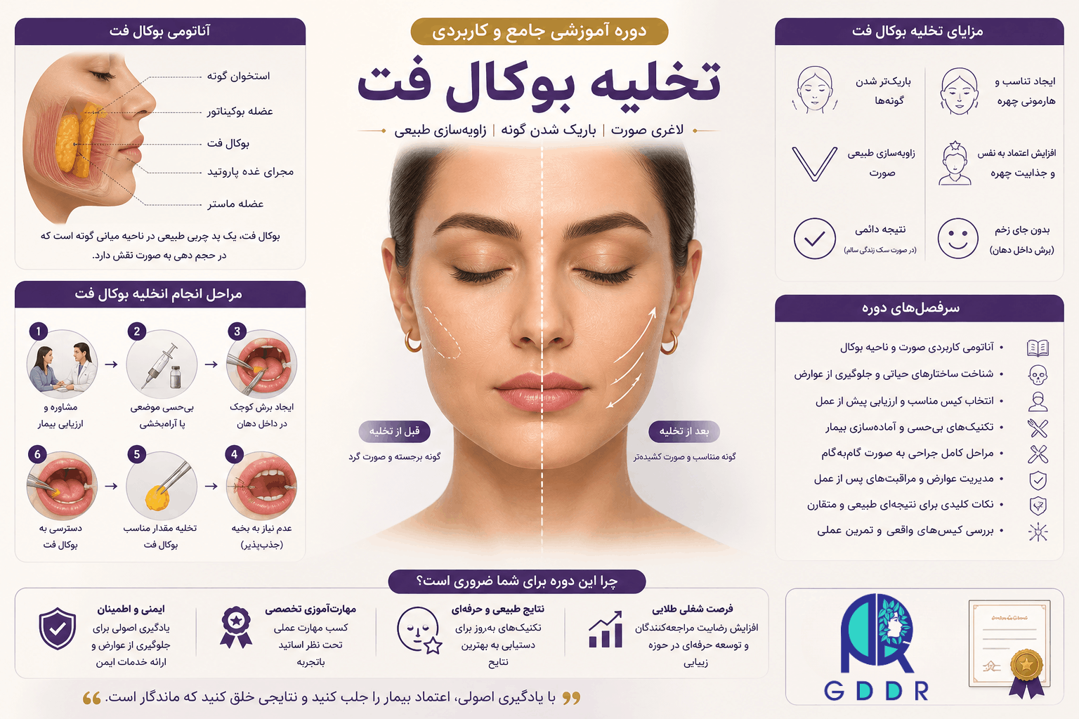 آموزش تخلیه بوکال فت