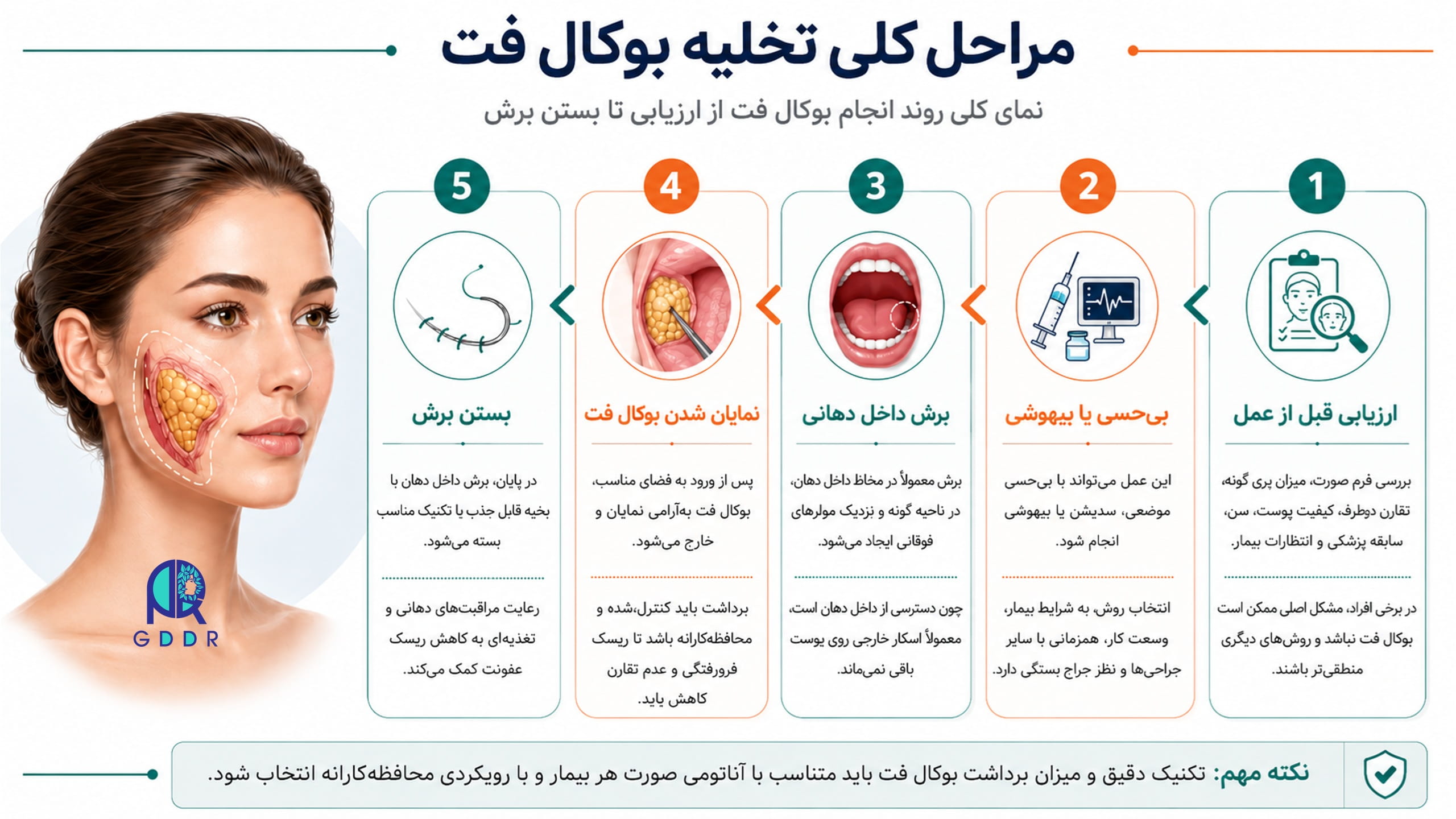 تصویری اینفوگرافیک برای نشان دادن مراحل مختلف انجام فرایند تخلیه بوکال فت