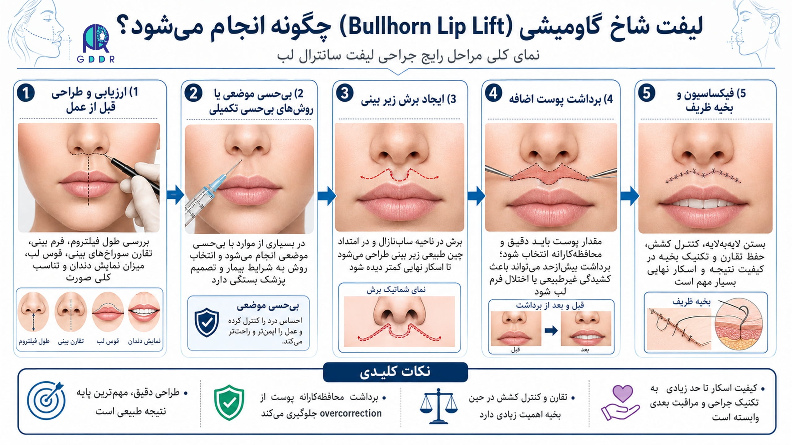 لیفت سانترال لب چگونه و در چه مراحلی انجام میشود؟ اینفوگراف