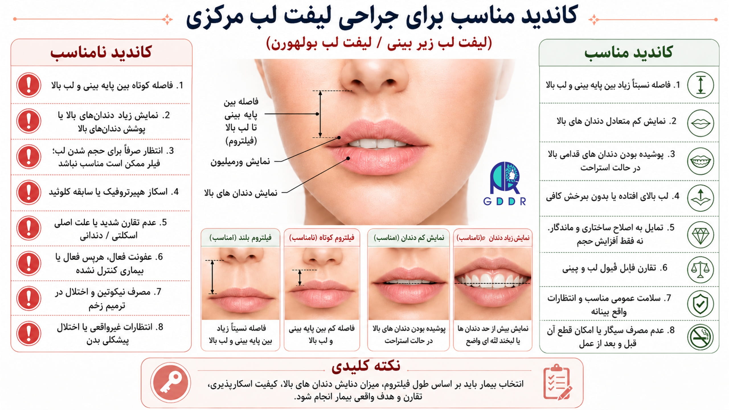 چه کسی کاندید مناسبی برای لیفت سانترال لب است؟ چه کسی کاندید مناسبی نیست؟