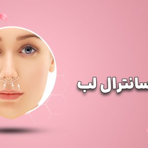 دوره لیفت سانترال لب