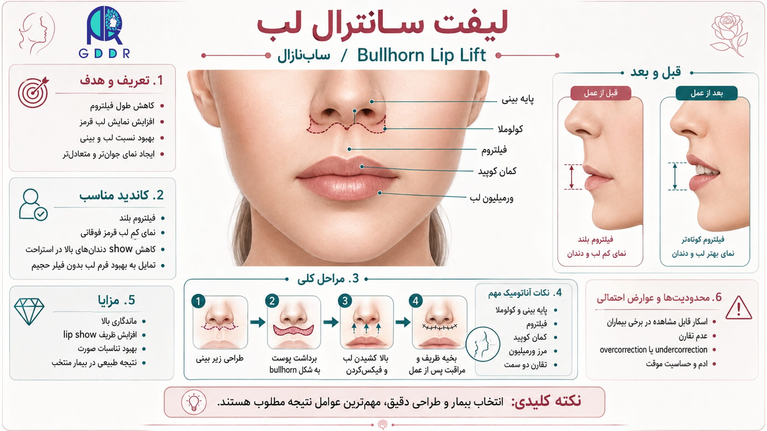 آنچه باید بصورت خلاصه از لیفت سانترال لب بدانید!