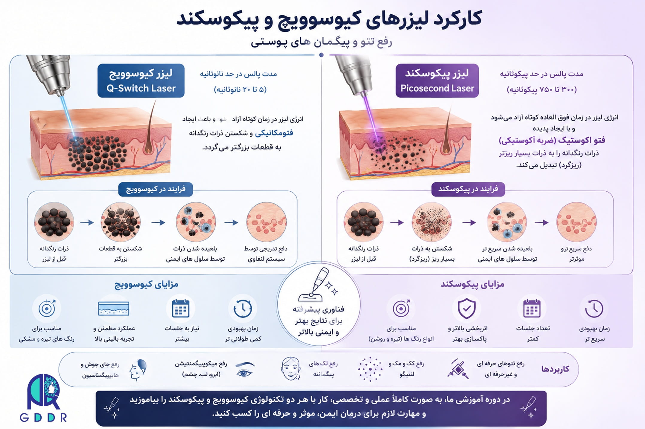 آموزش لیزر کیوسوویچ