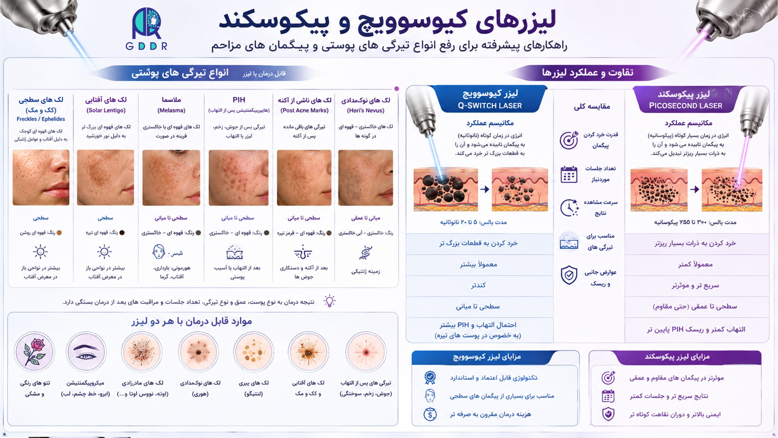 اینفوگراف مروری برای جمع بندی آموزش رفع تتو با لیزر کیوسوویچ و پیکوسکند