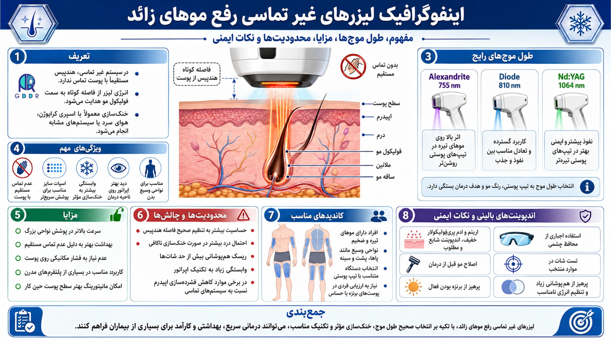 بررسی ابعاد مختلف لیزرهای غیرتماسی رفع موهای زاید بصورت اینفوگرافیک