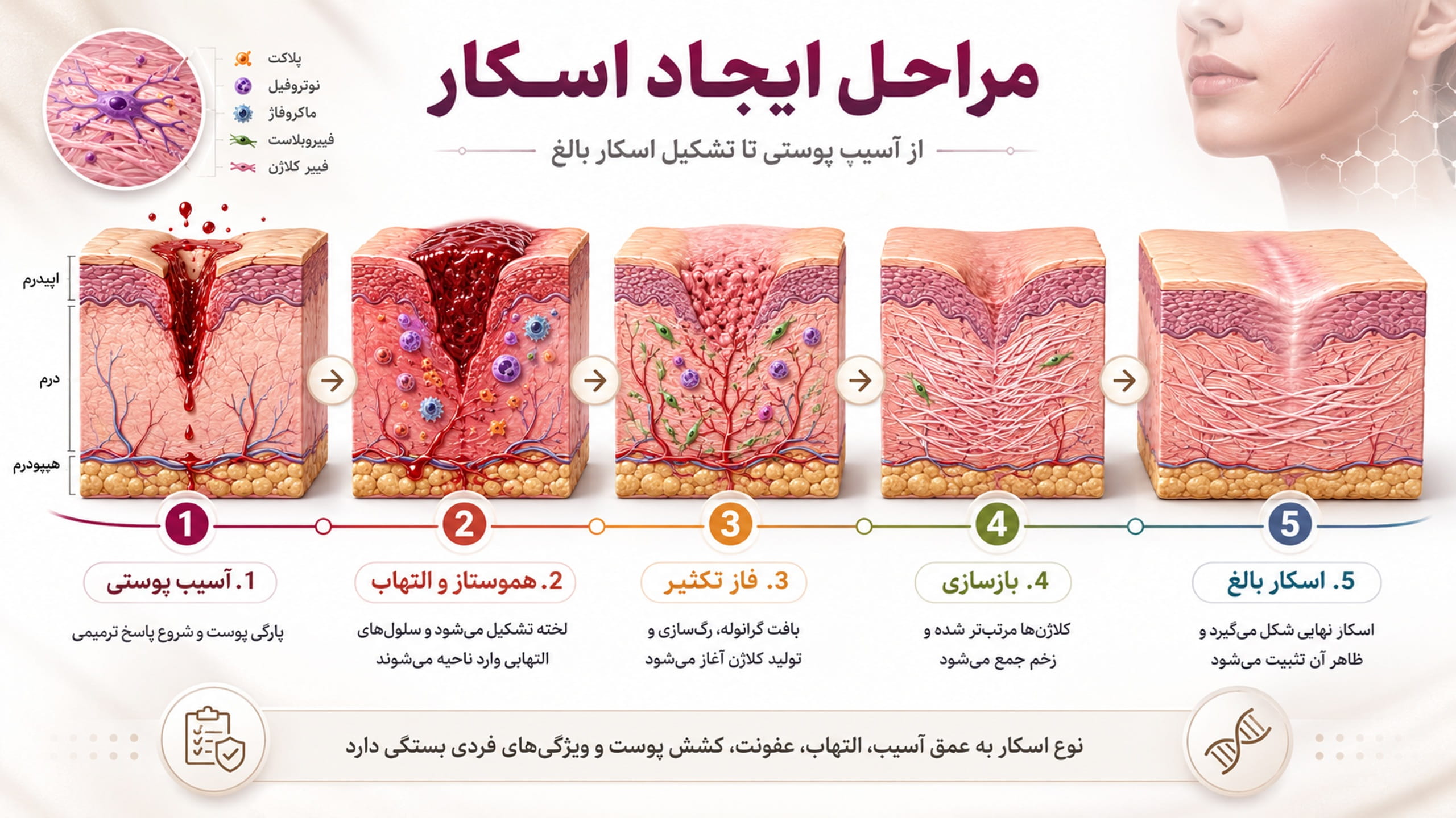 مراحل ایجاد اسکارها و اتیولوژی کلی آن در یک تصویر جامع اینفوگرافیک