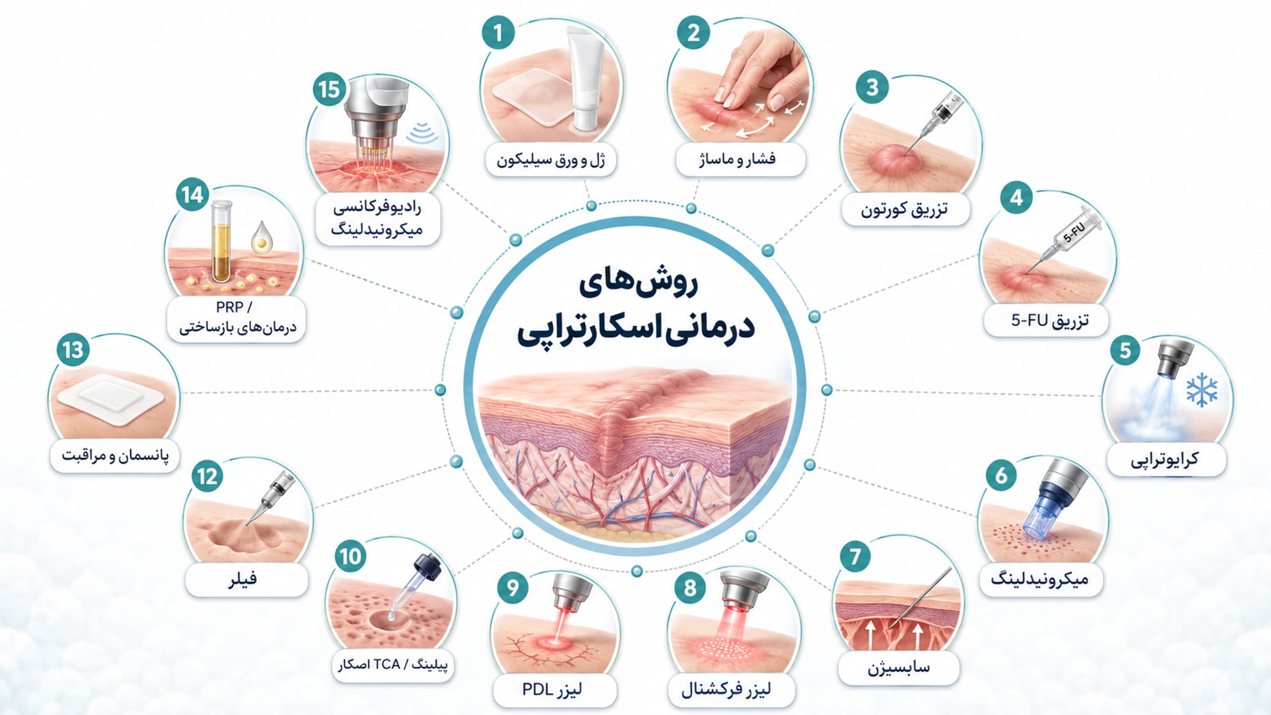 روشهای درمانی مورد استفاده دز زمینه اسکارتراپی و درمان های ترکیبی بصورت تصویری اینفوگرافیک