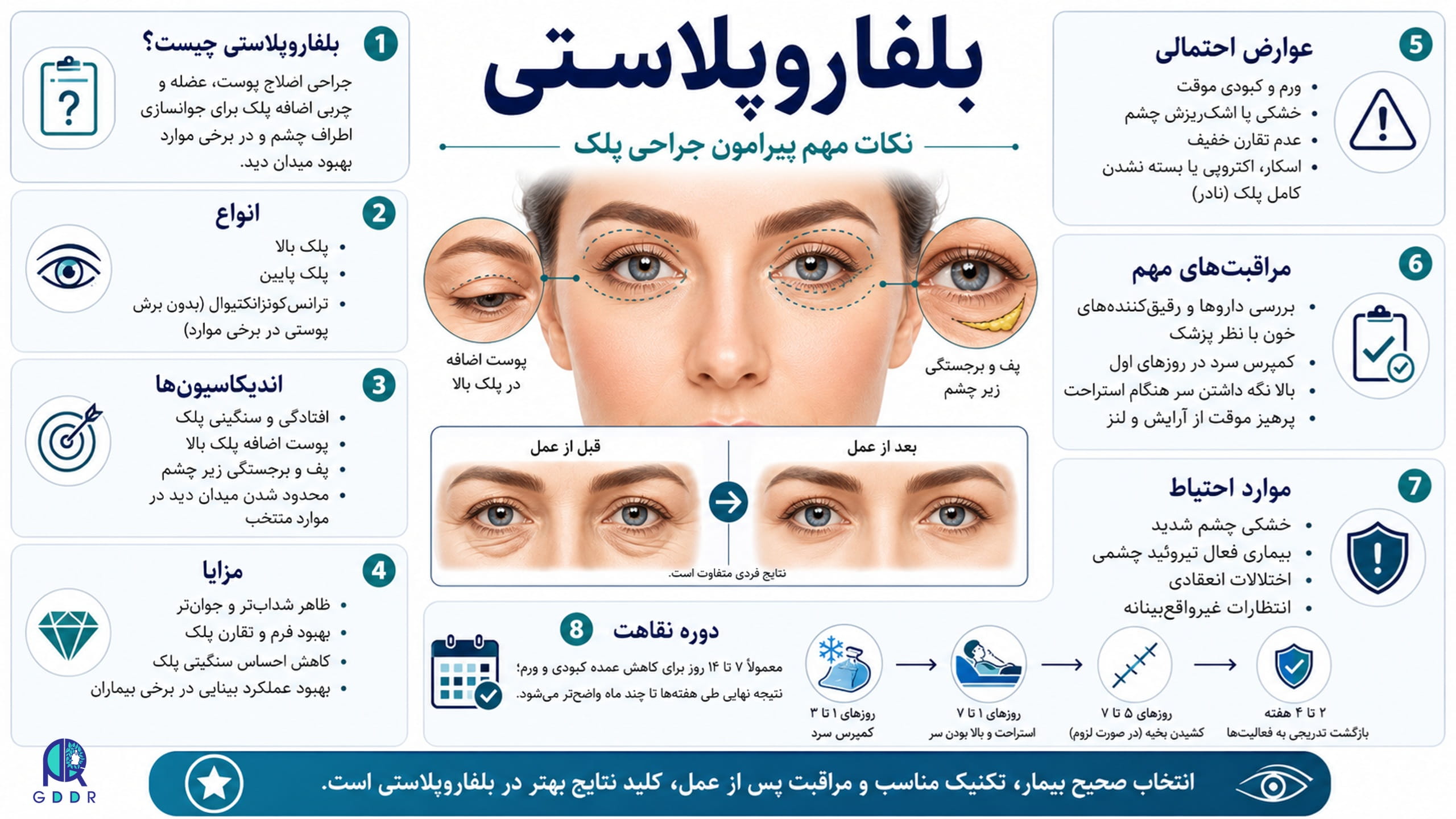 جنبه های مهم بلفاروپلاستی