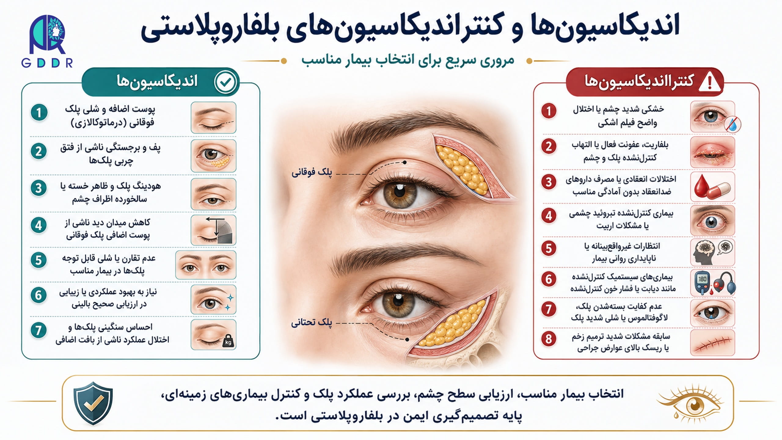 اندیکاسیونها و کنترااندیکاسیونهای بلفاروپلاستی بصورت یک تصویر اینفوگرافیک