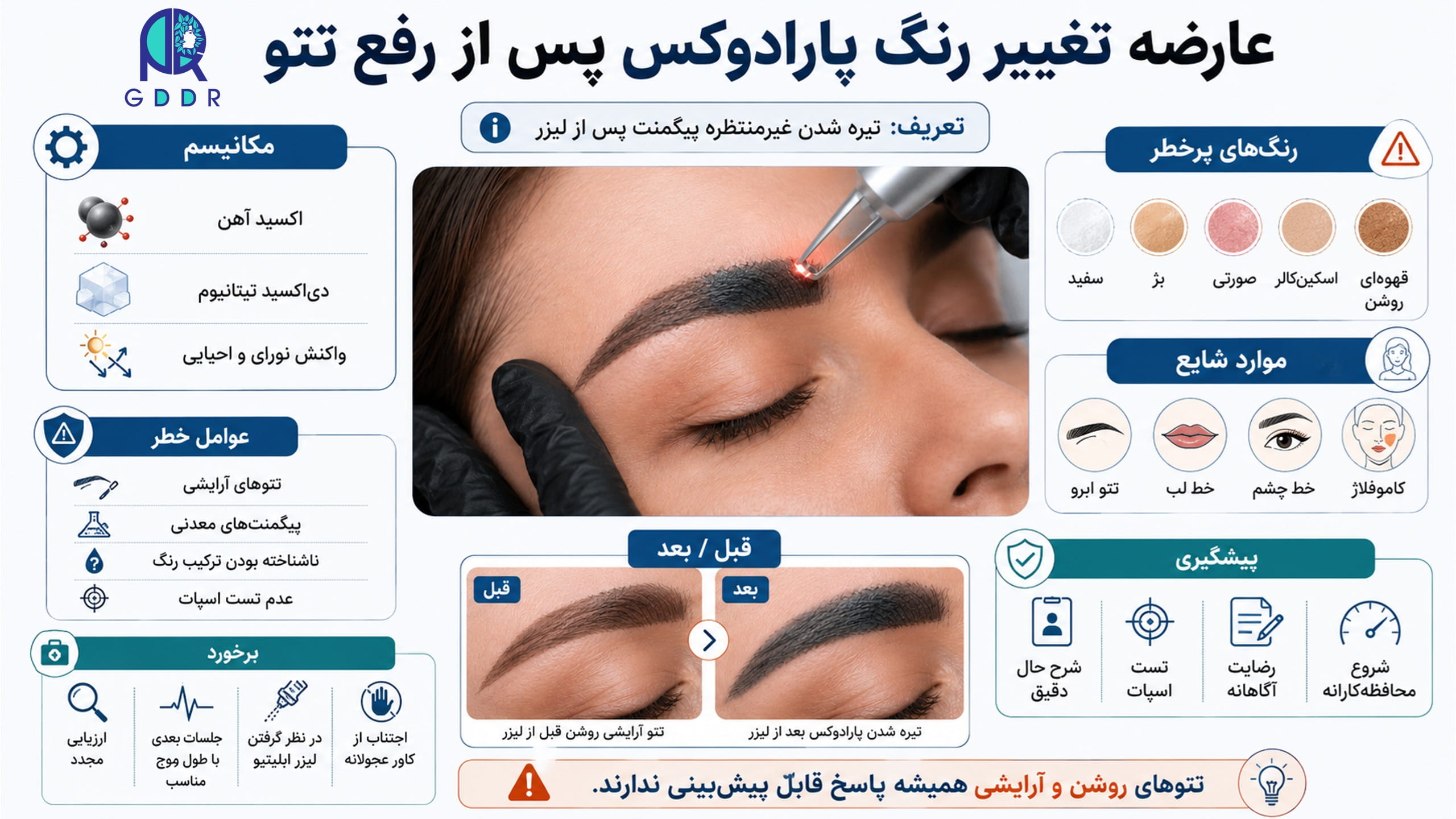 تغییر رنگ پارادوکس چیست؟ در چه تتو هایی بیشتر اتفاق می افتد؟ تصویری اینفوگرافیک