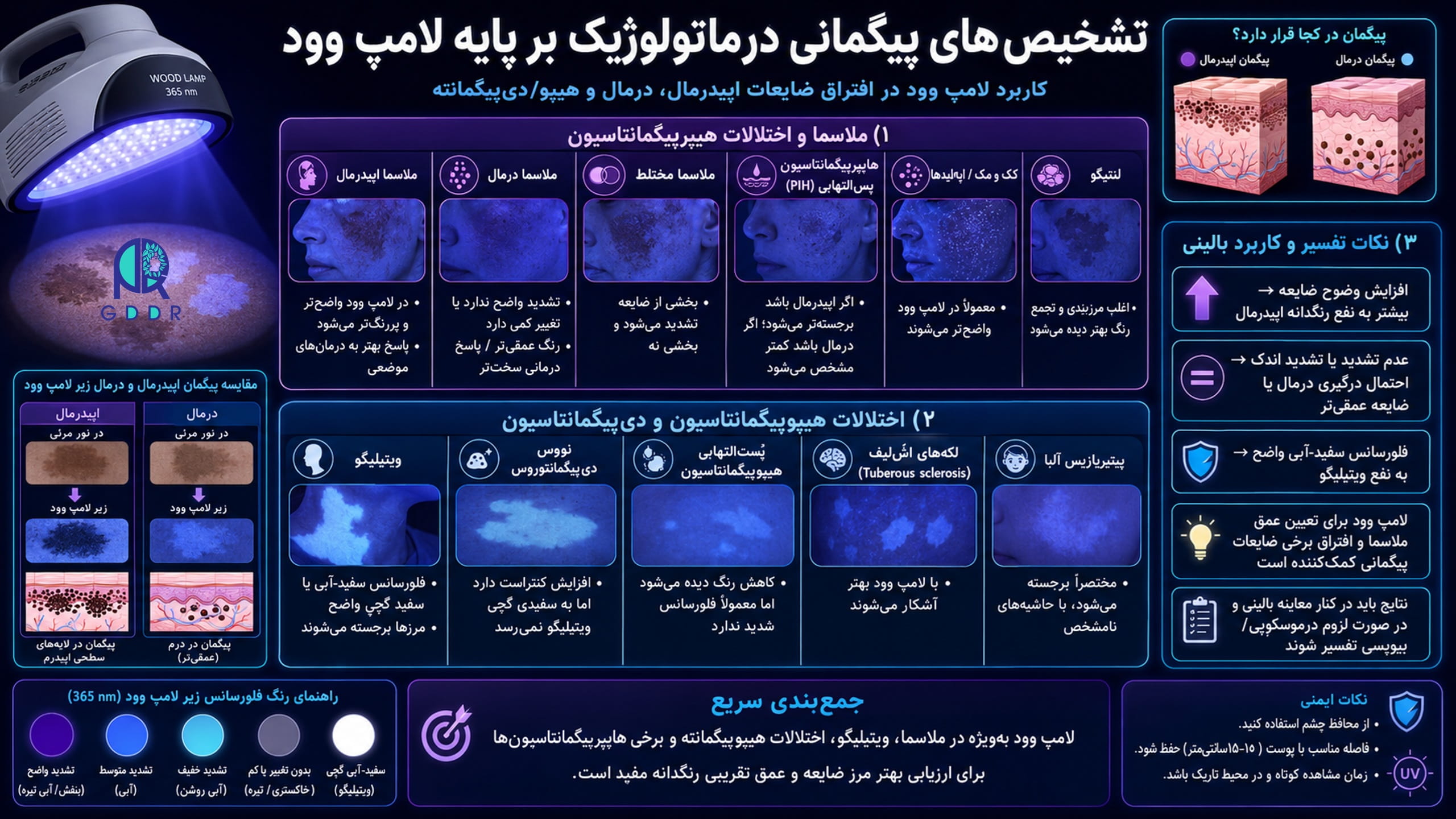 کاربردهای تشخیصی لامپ وود، در برخورد با اختلالات پیگمانی و درماتولوژیک در یک تصویر جامع اینفوگرافیک