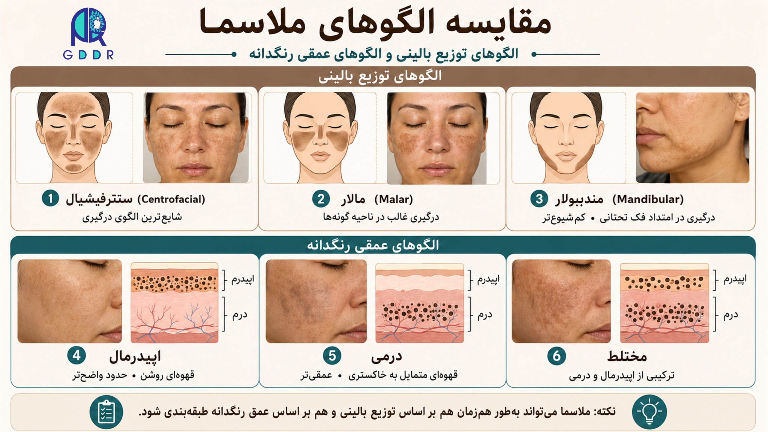 بررسی الگوهای رایج درگیری در بروز ملاسما بصورت یک تصویر اینفوگرافیک جامع